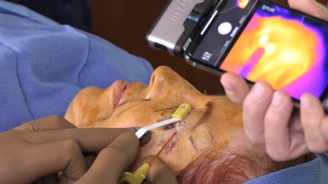 Accutite Final ***Warning! This Video Is Graphic!***